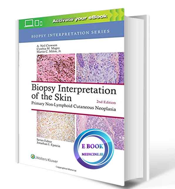 دانلود کتابBiopsy Interpretation of the Skin: Primary Non-Lymphoid Cutaneous Neoplasia  2nd 2018 ( PDF) 